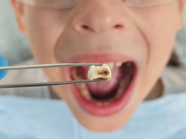 Best Cracked Tooth Emergency Dentist  in Yorketown, NJ