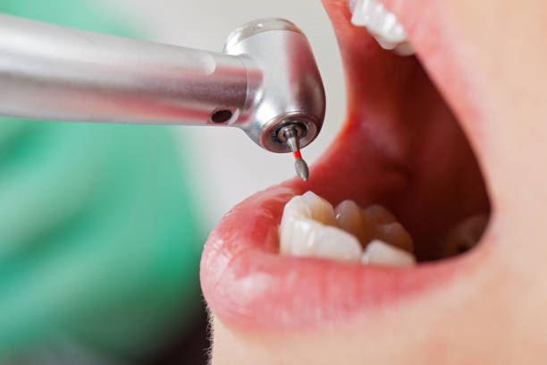 Best Tooth Infection Emergency Dentist  in Yorketown, NJ